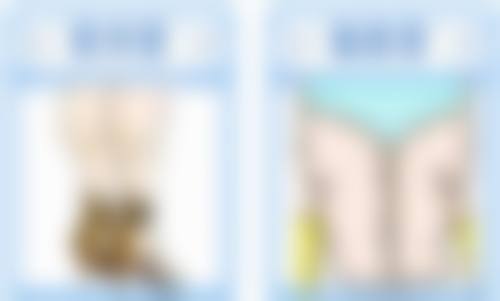 打瘦脸针的常见疑问解答