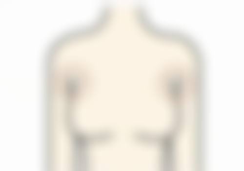 什么年龄适合除皱针？25 - 60 岁各年龄段打除皱针的优势大揭秘，让你抗衰不走弯路！ 