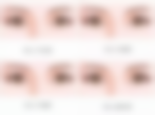 头发种植后会再次脱落吗？揭秘95%成功率背后的真相，3大关键因素确保种植头发持久浓密！ 