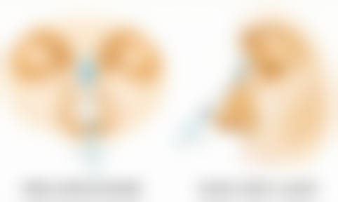 头发种植是恒久的吗