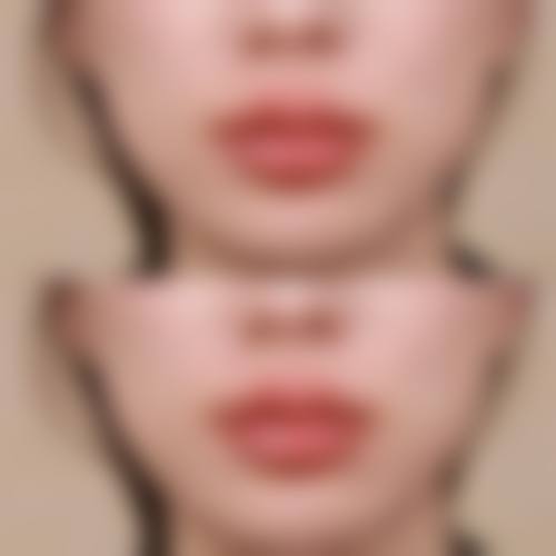 【北京聚美欧华医疗美容医院参考价格表：】