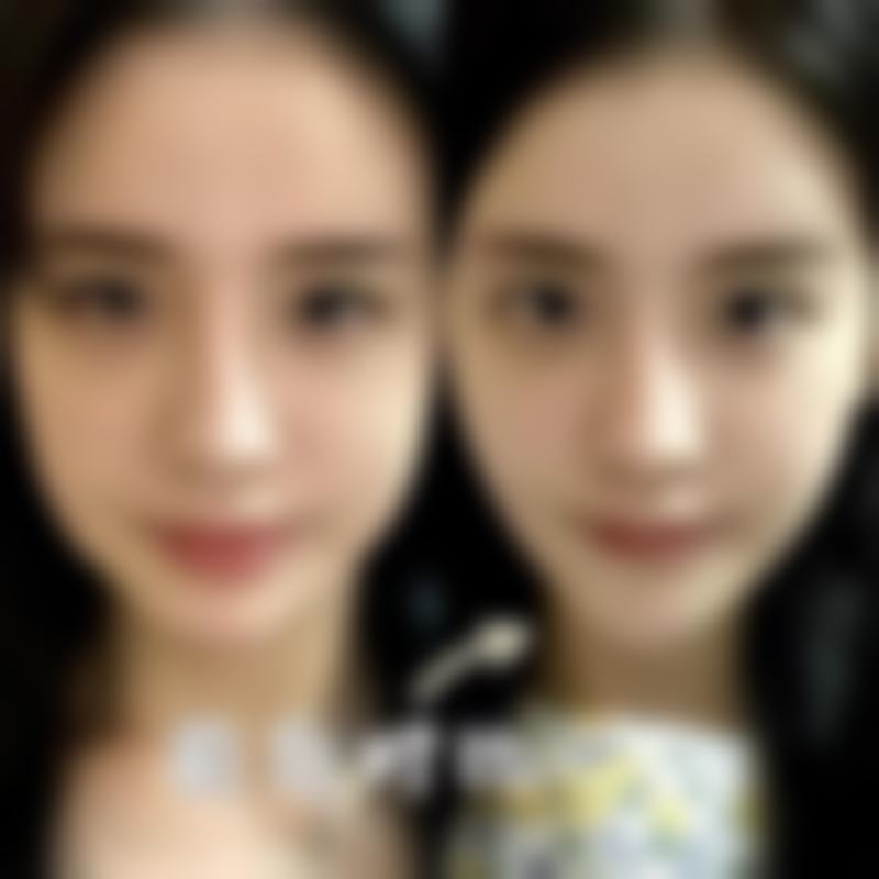 做阴道紧缩术到底有没有效果？揭秘术后真实改善率超 80%，重塑女性自信，畅享高品质生活！ 