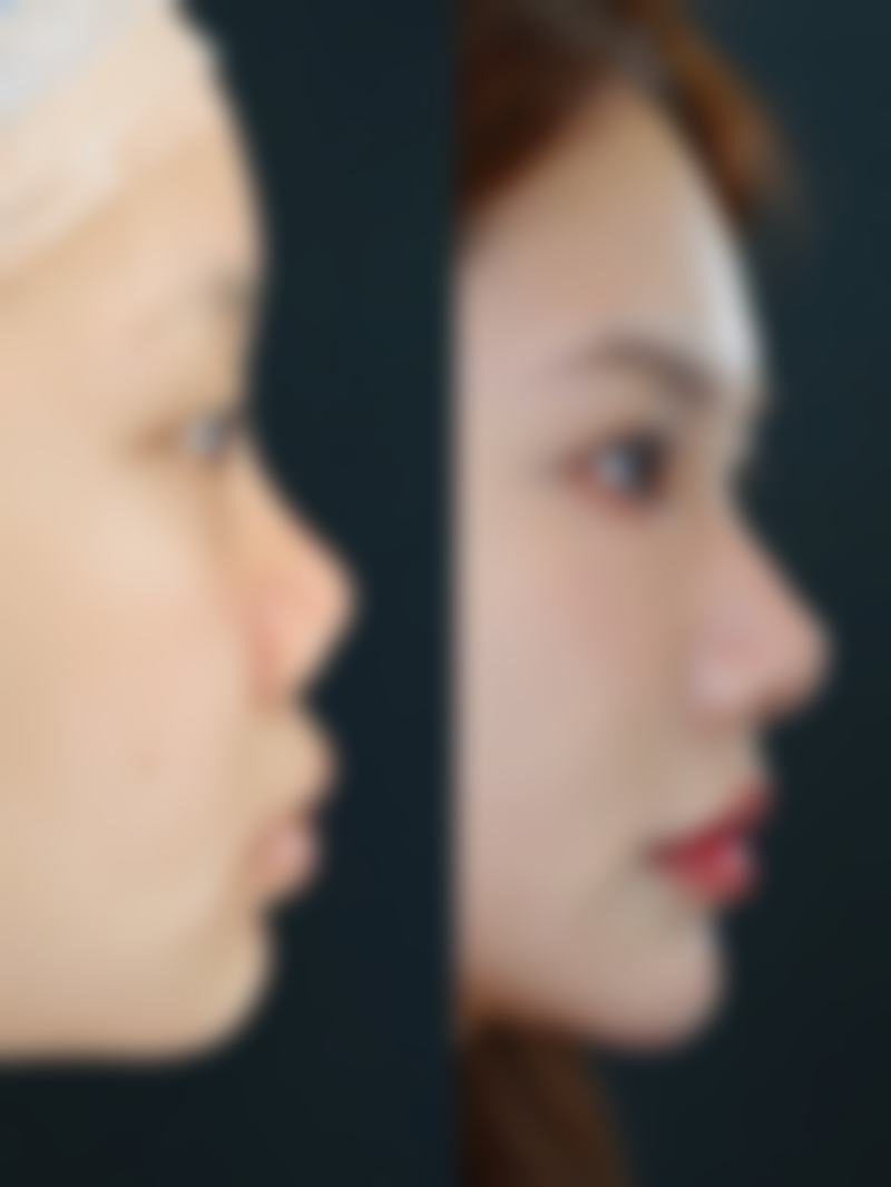 【天门忆美整形美容机构患者口碑评价：】