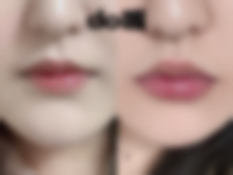 嘴唇厚的和嘴唇薄的哪个好