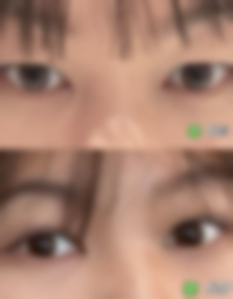 【珠海科美整形美容医院参考价格表:】