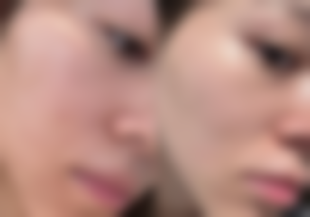 以下是东莞美后医疗美容门诊部部分项目的参考价格表（价格仅供参考，实际以到院面诊为准）：