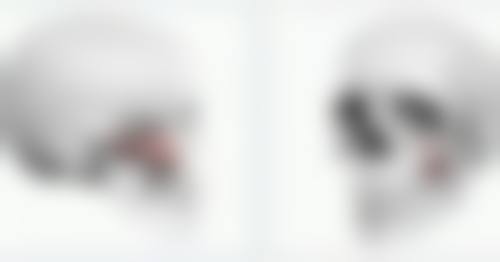 美白针能祛斑吗