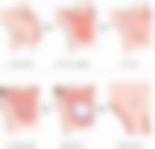 除皱针的价格一般是多少