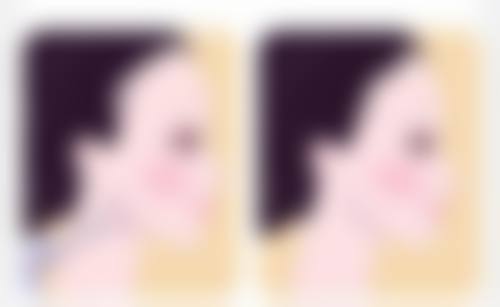 种植头发真的可以自然生长吗