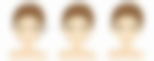 为什么要打瘦脸针？3大显著优势、5种脸型适配、100%满意度，带你解锁精致小脸新秘诀！ 