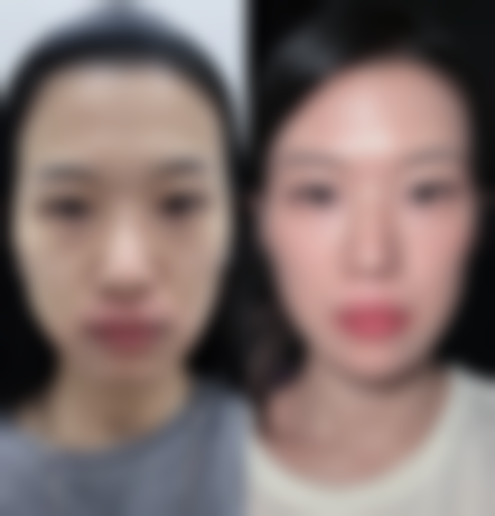 【广州悟空祛痘医疗美容门诊部怎么预约挂号?】