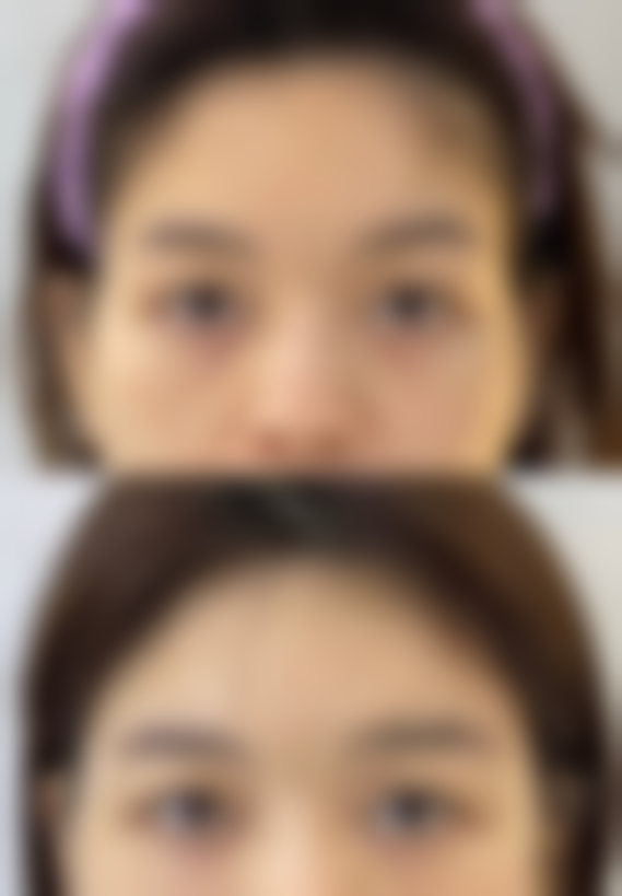 四川成都美容整形医院私密科李挺在处女膜修复方面的优势有哪些？