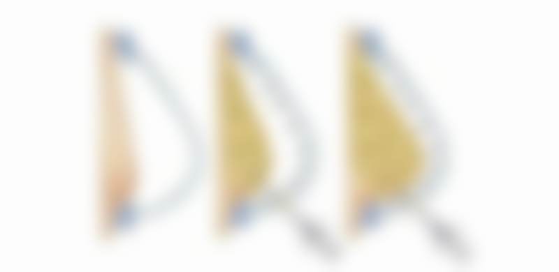 【祁爱琳医生口碑评价】