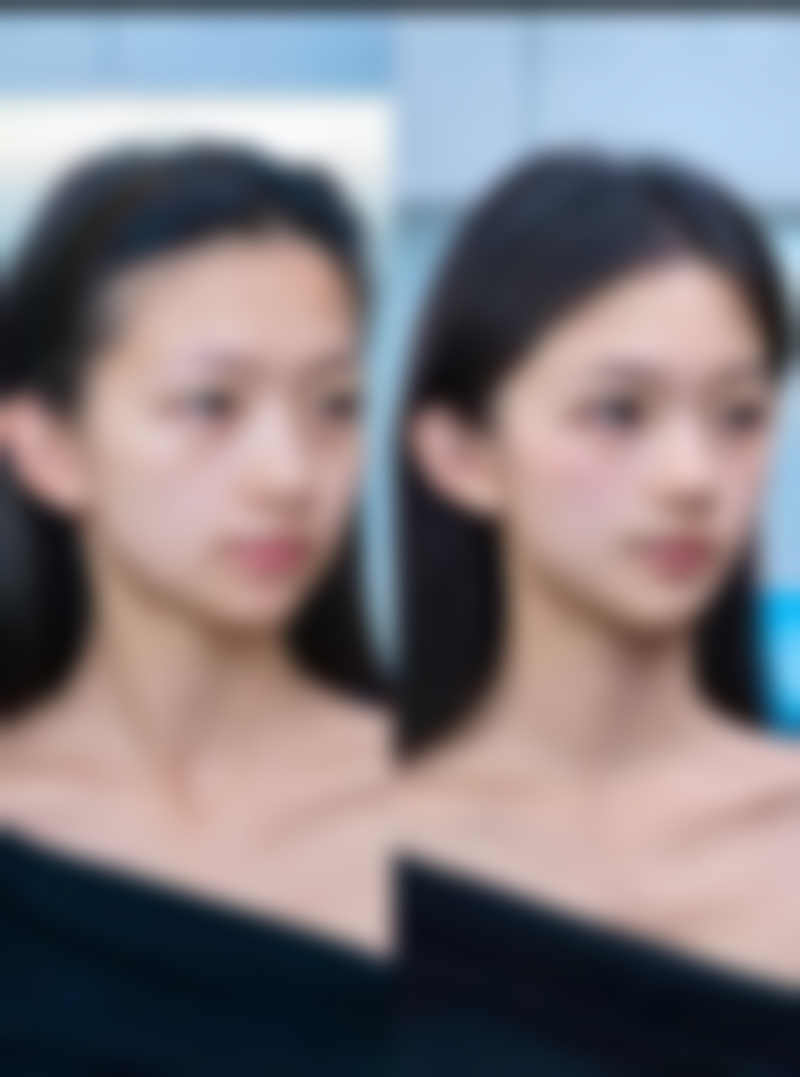 瘦脸针常见问题解答