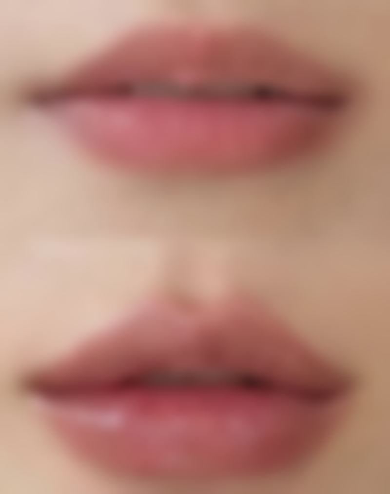 水光针微针治疗时间小时后可以正常护肤