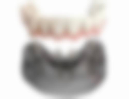 除皱针打一次有成效吗