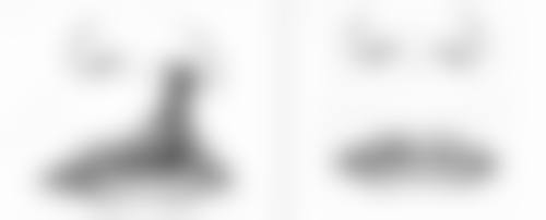 打除皱针一针能维持多久时间