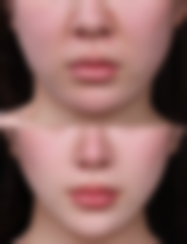 【南充汇欣圣博丽尔医疗美容门诊部诊疗设备：】