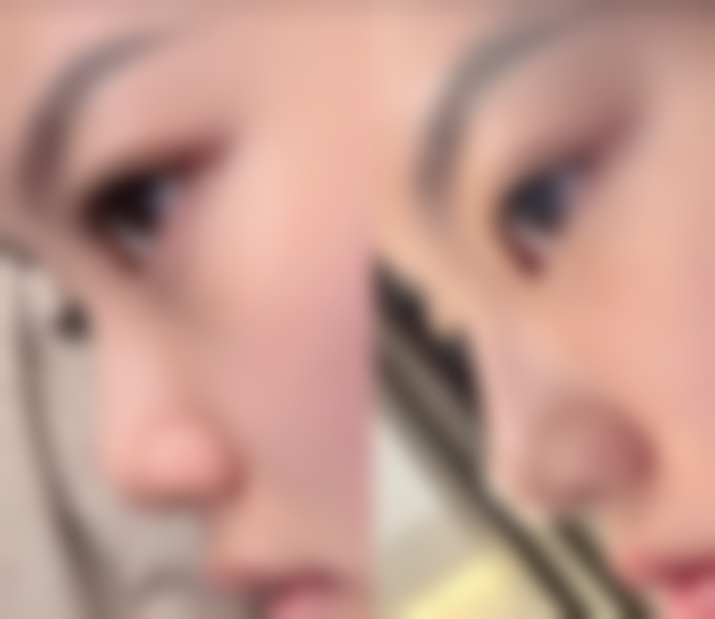 【南充汇欣圣博丽尔医疗美容门诊部参考价格表：】