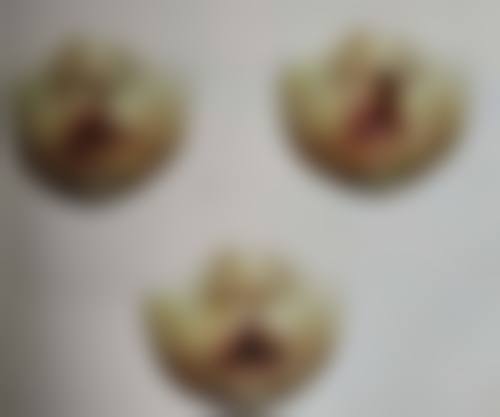 微针可以去皱纹