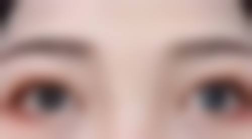 如何降低长期打瘦脸针的危害