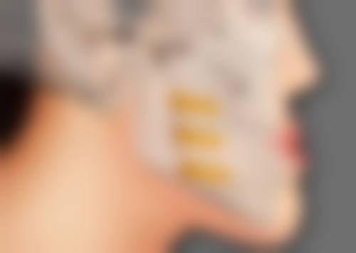 长期打瘦脸针的副作用及后果