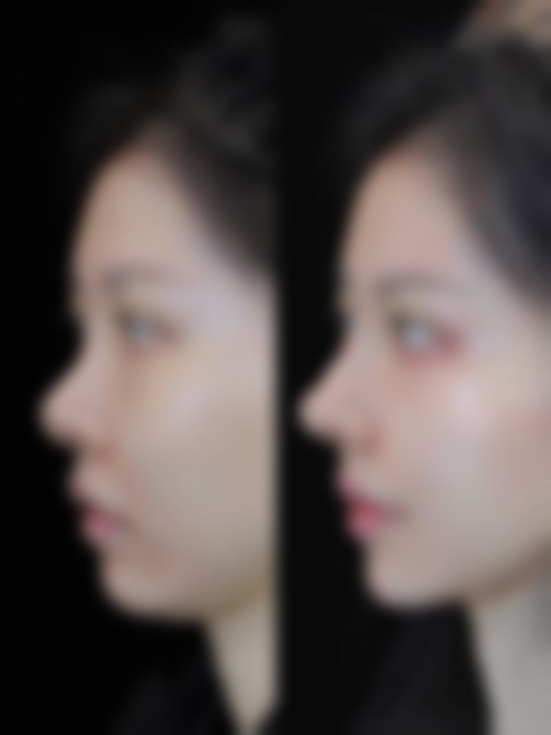 评价三:“我做了注射激光项目,整个体验过程非常好。医院的环境特别舒适,服务人员热情周到。医生在操作过程中特别细心,会随时和我沟通感受。术后的成效也特别让我满意,皮肤变得更加有光泽了。以后有美容需求还会来这里。”