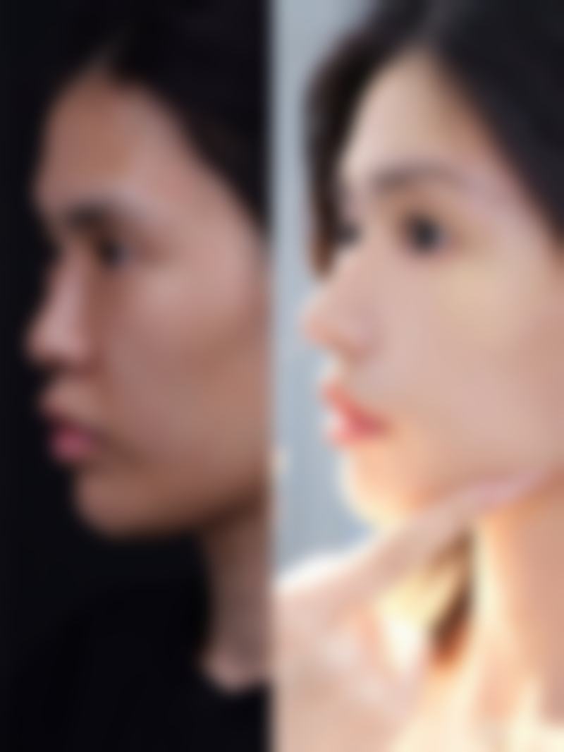 【广州飞悦整形医疗美容医院是正规的吗?】