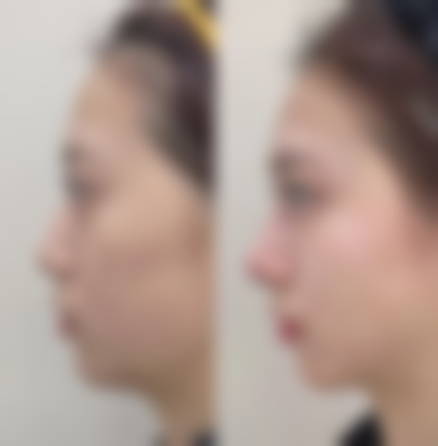 【杨鹏云医生口碑怎么样?】