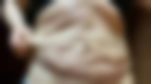 阴道紧缩手术真的有用吗