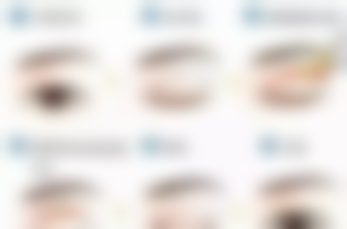 打完瘦脸针嘴角下垂