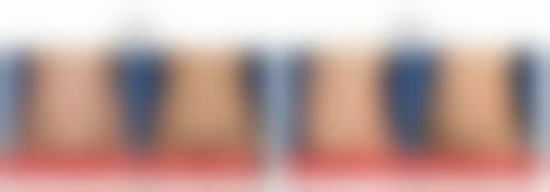 阴道紧缩手术真的有用吗？揭秘其改善性生活质量、预防妇科疾病的神奇功效，90%受术者都有显著效果！ 