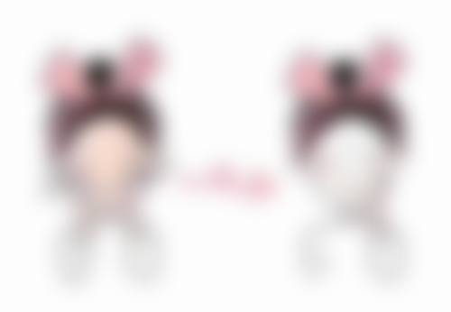 阴道紧缩手术能维持多久