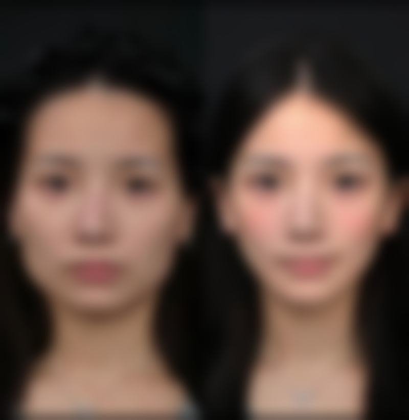 【石家庄星源美天医疗美容医院是正规的吗?】