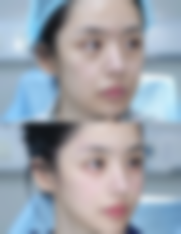 【杭州爱吉奥医疗整形医院是正规的吗?】