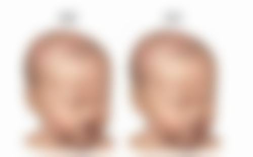 草莓怎么种植才能活的久