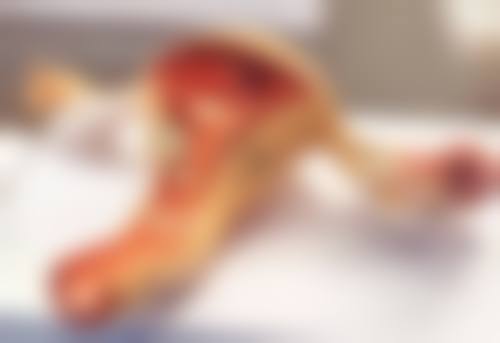 玻尿酸除皱有效吗