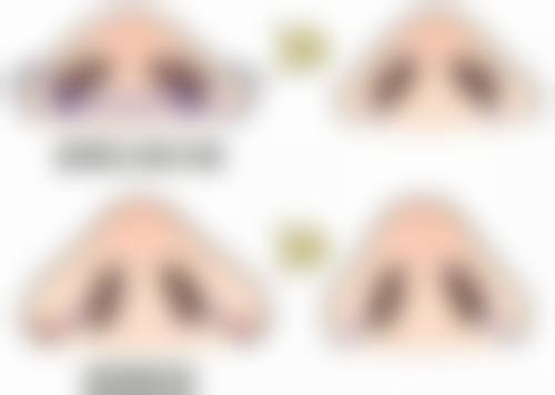 面部除皱针以后有危害吗？揭秘3大常见顾虑，正规操作下除皱针实则利大于弊！ 