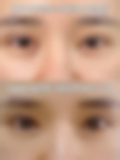 【阜新安琪美整形医院患者口碑评价：】