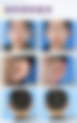 【连云港徐医生美容整形诊所医生名单：】