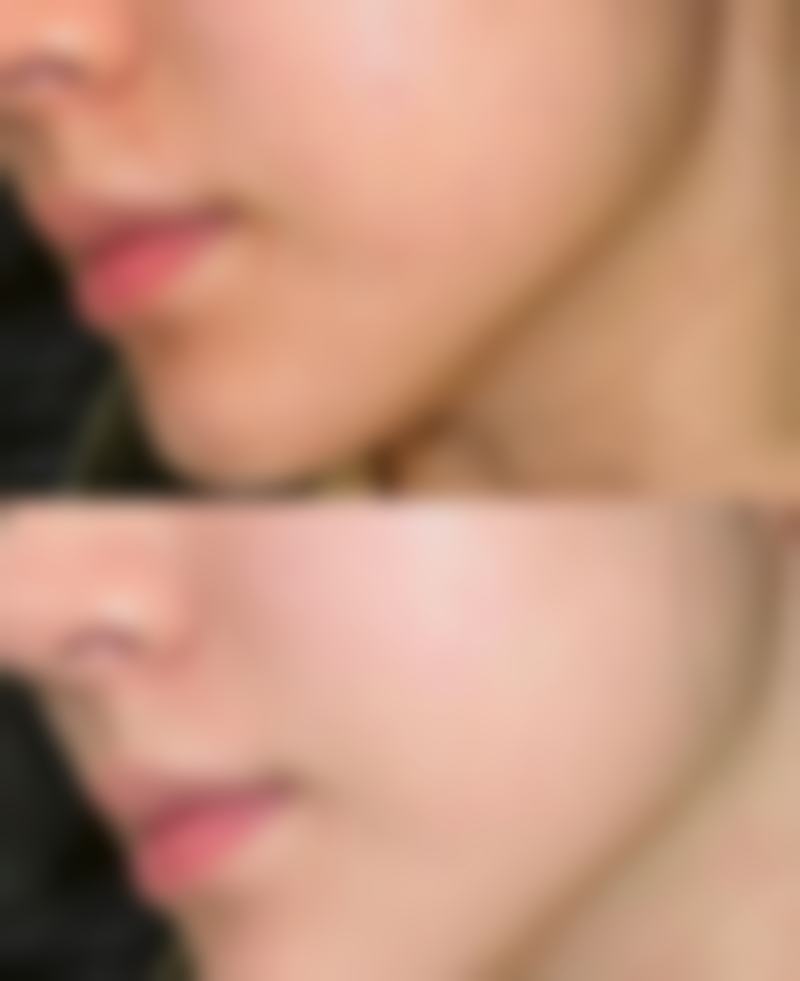 【北京玲珑梵宫整形医院特色项目：】