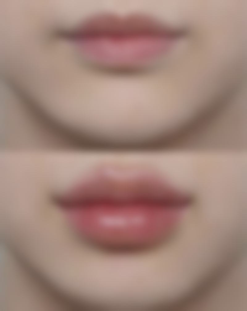 面部除皱的价格参考