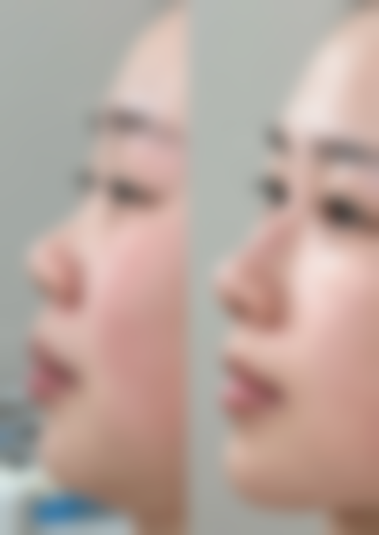 草莓怎么种植才能活？掌握5个关键步骤，轻松种出又大又甜的草莓，让你的阳台变草莓园！ 