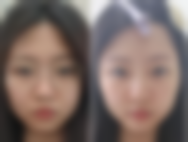 【北京玲珑梵宫整形医院患者口碑评价：】