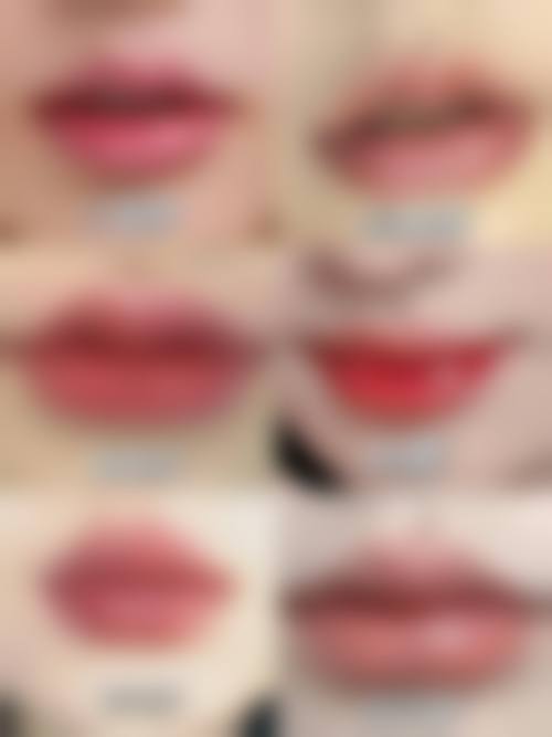 【南华大学附属第二医院（烧伤整形美容科）参考价格表：】