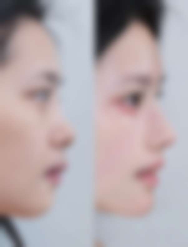 【韩国GOODLINE整形医院地址：】