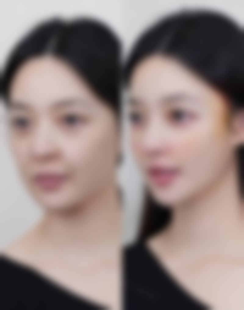 【韩国GOODLINE整形医院诊疗设备：】