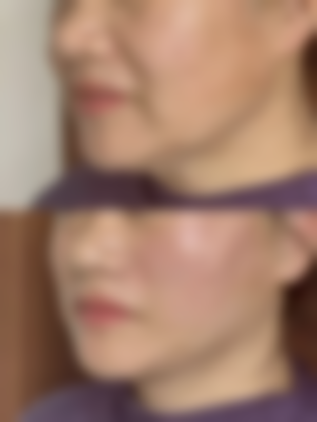 【金华玥莱美整形设备与技术：】