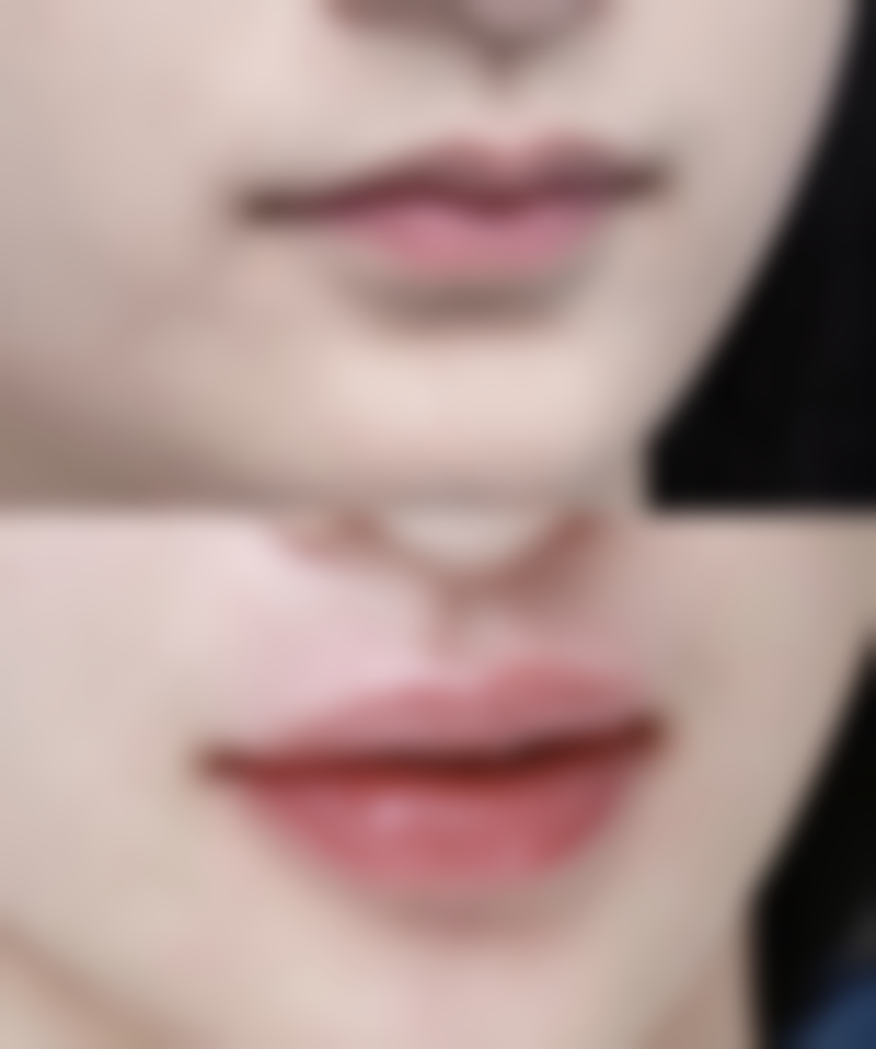 【金华玥莱美整形是正规的吗?】