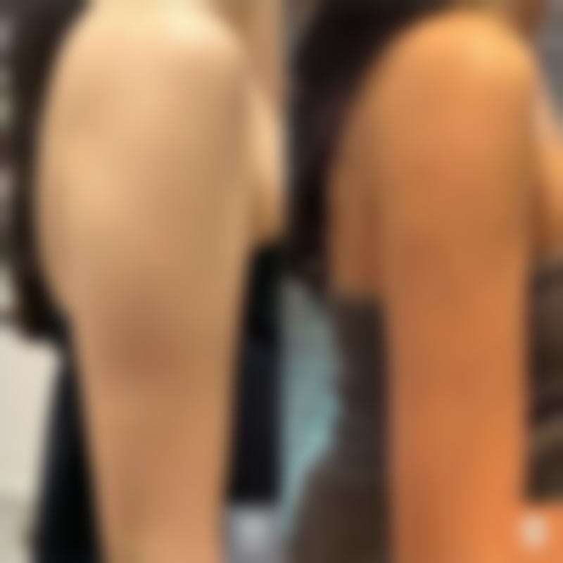 打瘦脸针会不会对身体有伤害